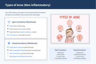 Non Inflamed Acne: Causes, Treatment, and Prevention.pdf