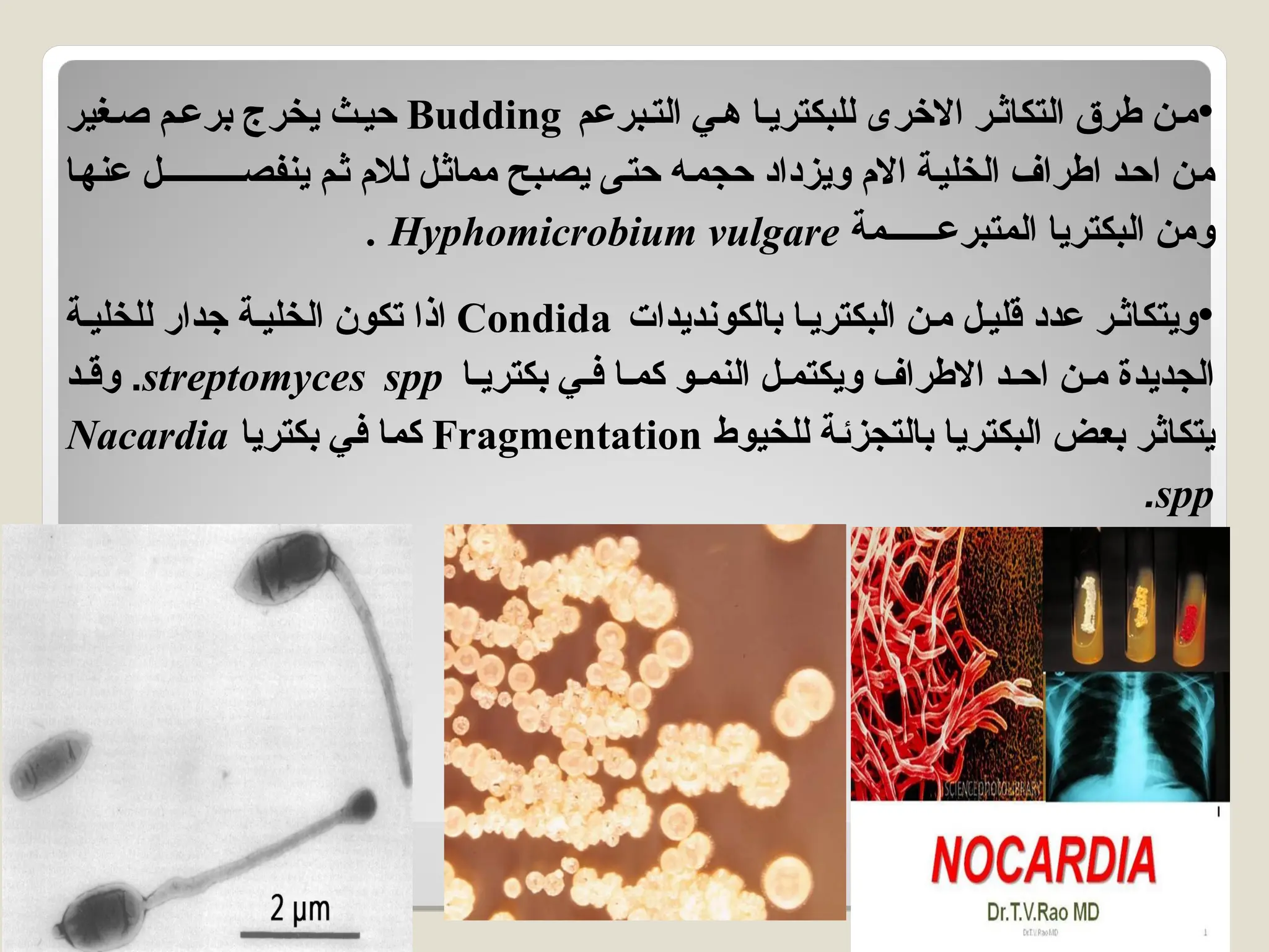 •
‫التبرعم‬ ‫ي‬a‫ه‬ ‫للبكتريا‬ ‫االخرى‬ ‫ر‬a‫التكاث‬ ‫طرق‬ ‫ن‬a‫م‬
Budding
‫غير‬a‫ص‬ ‫م‬a‫برع‬ ‫يخرج‬ ‫حيث‬
‫ا‬a‫ه‬‫عن‬ ‫ـــــــــل‬a‫ص‬‫ينف‬ ‫م‬a‫ث‬ ‫لالم‬ ‫ل‬a‫ث‬‫مما‬ ‫بح‬a‫ص‬‫ي‬ ‫حتى‬ ‫حجمه‬ ‫ويزداد‬ ‫االم‬ ‫الخلية‬ ‫اطراف‬ ‫احد‬ ‫ن‬a‫م‬
‫المتبرعــــــمة‬ ‫البكتريا‬ ‫ومن‬
Hyphomicrobium vulgare
.
•
‫بالكونديدات‬ ‫البكتريا‬ ‫ن‬a‫م‬ ‫قليل‬ ‫عدد‬ ‫ر‬a‫ويتكاث‬
Condida
‫للخلية‬ ‫جدار‬ ‫الخلية‬ ‫تكون‬ ‫اذا‬
‫بكتريا‬ ‫ي‬a‫ف‬ ‫كما‬ ‫النمو‬ ‫ويكتمل‬ ‫االطراف‬ ‫احد‬ ‫ن‬a‫م‬ ‫الجديدة‬
streptomyces spp
.
‫د‬a‫وق‬
‫للخيوط‬ ‫ة‬a‫ئ‬‫بالتجز‬ ‫البكتريا‬ ‫بعض‬ ‫ر‬a‫ث‬‫يتكا‬
Fragmentation
‫بكتريا‬ ‫ي‬a‫ف‬ ‫كما‬
Nacardia
spp
.
 