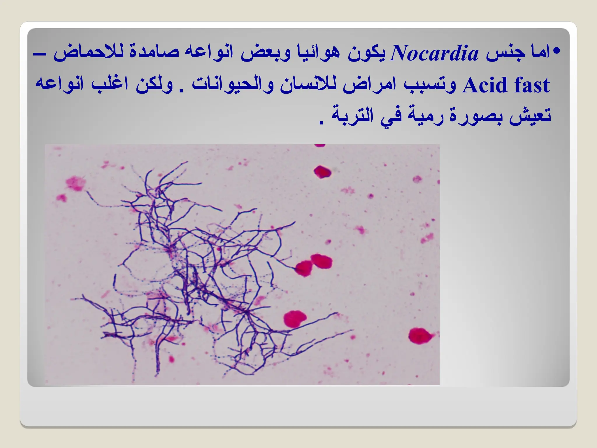 •
‫جنس‬ ‫اما‬
Nocardia
– ‫لالحماض‬ ‫صامدة‬ ‫انواعه‬ ‫وبعض‬ ‫هوائيا‬ ‫يكون‬
Acid fast
‫انواعه‬ ‫اغلب‬ ‫ولكن‬ . ‫والحيوانات‬ ‫لالنسان‬ ‫امراض‬ ‫وتسبب‬
. ‫التربة‬ ‫في‬ ‫رمية‬ ‫بصورة‬ ‫تعيش‬
 