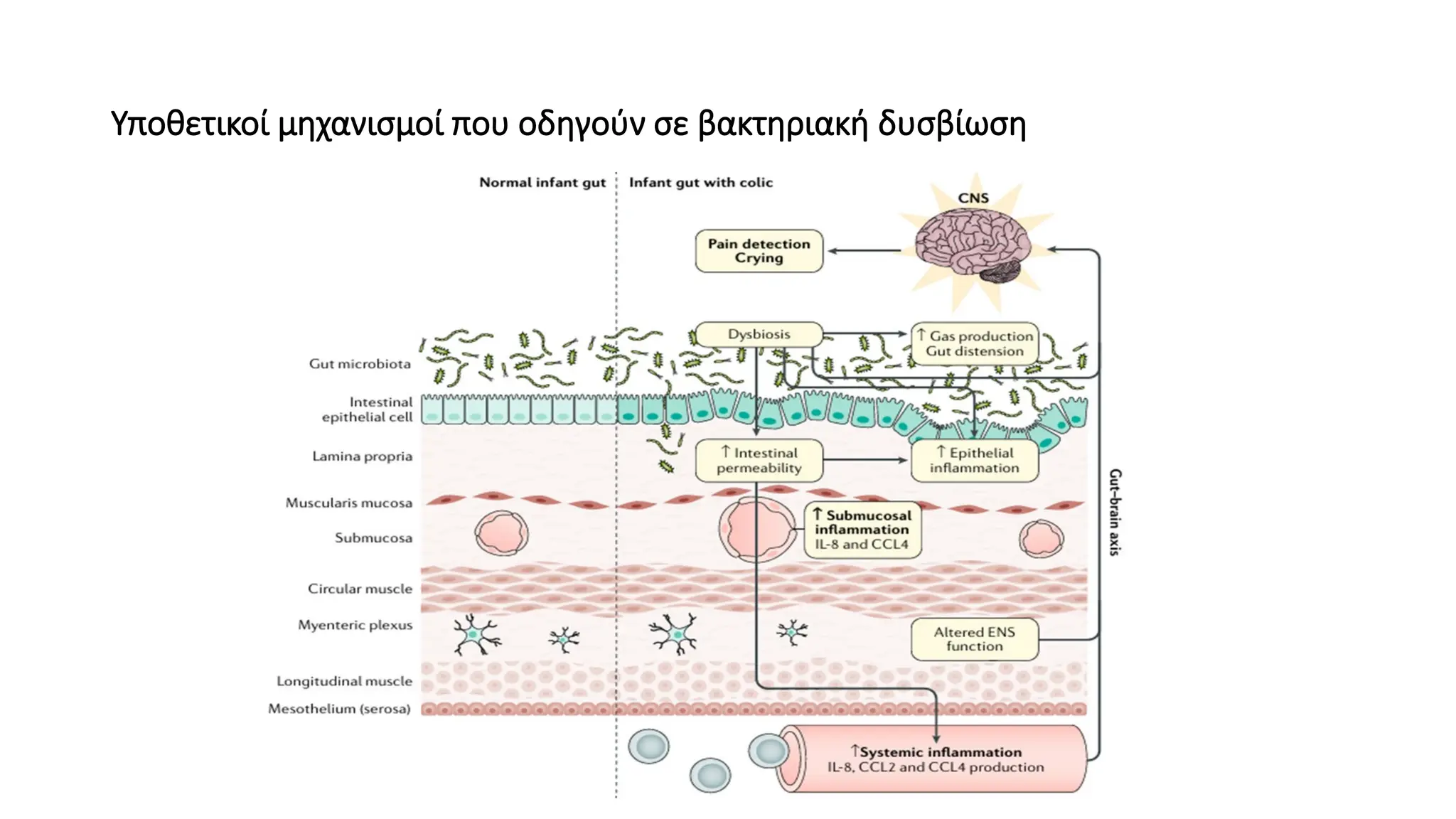 Υποθετικοί μηχανισμοί που οδηγούν σε βακτηριακή δυσβίωση
 