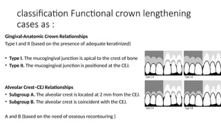 Esthetic crow lengthening surgery تطويل التيجان جراحيا.pptx