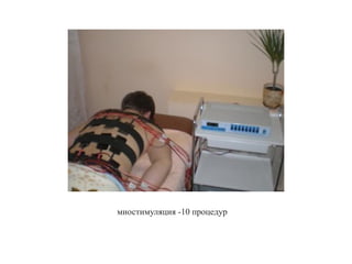 миостимуляция -10 процедур
 
