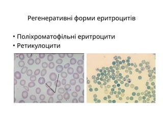 Регенеративні форми еритроцитів
• Поліхроматофільні еритроцити
• Ретикулоцити
 