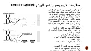FRAGILE X SYNDROME ‫الهش‬ ‫إكس‬ ‫الكروموسوم‬ ‫متالزمة‬

‫ي‬#‫ه‬ ّ#‫ش‬َ‫ه‬‫ال‬ ‫س‬#‫إك‬ ‫وم‬#‫كروموس‬ ‫ة‬#‫متالزم‬ ‫ن‬#‫إ‬
‫ة‬#‫م‬‫المتالز‬ ‫هذه‬ ‫ق‬#‫ل‬‫تتع‬ ‫ث‬#‫ي‬‫ح‬ ‫ة‬#‫ي‬‫وراث‬ ‫ة‬#‫م‬‫متالز‬
‫د‬#
‫ن‬‫ع‬ ‫الموجود‬ ‫س‬#
‫ك‬‫إ‬ ‫وم‬#
‫س‬‫بالكرومو‬ ‫مباشرة‬
‫ة‬###‫المتالزم‬ ‫هذه‬ ‫ن‬###‫فإ‬ ‫ي‬###‫وبالتال‬ ،‫األمهات‬
‫د‬##‫يوج‬ ‫ث‬##‫حي‬ ‫الرجال‬ ‫ط‬##‫وس‬ ‫ر‬##‫أكث‬ ‫منتشرة‬
‫الكروموسوم‬ ‫ن‬#
#‫م‬ ‫واحدة‬ ‫خة‬#
#‫نس‬ ‫م‬#
#‫لديه‬
X
‫ا‬ً‫خطر‬ ‫ل‬#
#‫تشك‬ ‫الظاهرة‬ ‫هذه‬ ‫ن‬#
#‫فإ‬ ‫ي‬#
#‫وبالتال‬
.‫عليهم‬ ‫أكبر‬

:‫يأتي‬ ‫ما‬ ‫الكبار‬ ‫عند‬ ‫األعراض‬ ‫تشمل‬
•
‫و‬#
‫أ‬ ‫الجلوس‬ ‫ل‬#
‫ث‬‫م‬ ‫مهارات‬ ‫م‬#
‫ل‬‫تع‬ ‫ي‬#
‫ف‬ ‫عوبة‬#‫ص‬
.‫المشي‬ ‫أو‬ ‫الزحف‬
•
.‫والكالم‬ ‫اللغة‬ ‫في‬ ‫ل‬#
‫ك‬‫مشا‬
•
.‫بالعين‬ ‫االتصال‬ ‫وعدم‬ ‫باليد‬ ‫خفقان‬
•
.‫الغضب‬ ‫نوبات‬
•
.‫االت‬#
‫ع‬‫االنف‬ ‫على‬ ‫السيطرة‬ ‫ف‬#
‫ع‬‫ض‬
•
.‫قلق‬
•
.‫الصوت‬ ‫أو‬ ‫للضوء‬ ‫شديدة‬ ‫حساسية‬
•
.‫االنتباه‬ ‫في‬ ‫وصعوبة‬ ‫النشاط‬ ‫فرط‬
 