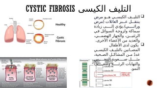 CYSTIC FIBROSIS ‫الكيسى‬ ‫التليف‬

‫و‬##‫ه‬ ‫ي‬##‫الكيس‬ ‫ف‬##‫التلي‬
‫مرض‬
(
‫مرض‬ ‫العائالت‬ ‫بر‬###‫ع‬ ‫ل‬###‫ينتق‬
)‫ي‬#####‫وراث‬
.
‫زيادة‬ ‫ى‬#####‫إل‬ ‫يؤدي‬
‫ي‬#‫ف‬ ‫وائل‬#‫الس‬ ‫ة‬#‫ولزوج‬ ‫ماكة‬#‫س‬
،‫ي‬###‫الهضم‬ ‫والجهاز‬ ،‫ن‬###‫الرئتي‬
.‫األخرى‬ ‫األعضاء‬ ‫من‬ ‫والعديد‬

‫األطفال‬ ‫لدى‬ ‫يكون‬
‫ي‬##‫الكيس‬ ‫ف‬##‫بالتلي‬ ‫ابين‬##‫المص‬
،‫حية‬#
#‫الص‬ ‫ل‬#
#‫المشاك‬ ‫ن‬#
#‫م‬ ٌ‫د‬‫عد‬
‫س‬#####‫التنف‬ ‫عوبة‬#####‫ص‬ ‫ل‬#####‫مث‬
‫ف‬#####‫وضع‬ ‫ة‬#####‫الرئ‬ ‫والتهابات‬
.‫النمو‬
 