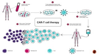 CAR-T cell therapy
 