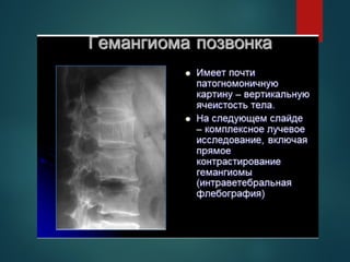 Comprehensive Overview of Bone Tumors: Classification, Diagnosis, and ...
