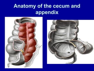 Comprehensive Overview of Appendicitis: Diagnosis, Treatment, and ...