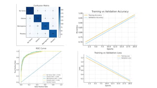 BRAIN TUMOR DETECTION USING MACHINE LEARNING | PPTX