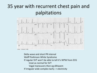 35 year with recurrent chest pain and
palpitations
Delta wave and short PR interval
Wolff Parkinson White Syndrome
If regular SVT won’t be able to tell it’s WPW from ECG
treat as normal for SVT
Vagal maneuvers then eg diltiazem
If irregular wide complex tachy -> electricity
 