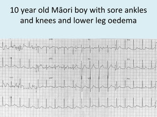 10 year old Māori boy with sore ankles
and knees and lower leg oedema
 