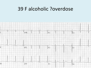 39 F alcoholic ?overdose
 