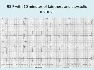 95 F with 10 minutes of faintness and a systolic
murmur
 