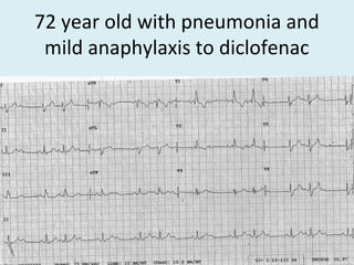 72 year old with pneumonia and
mild anaphylaxis to diclofenac
 