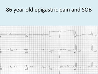 86 year old epigastric pain and SOB
 