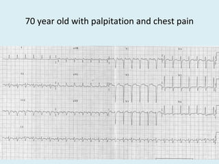 70 year old with palpitation and chest pain
 