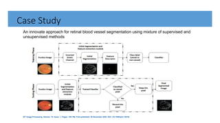 Case Study
An innovate approach for retinal blood vessel segmentation using mixture of supervised and
unsupervised methods
IET Image Processing, Volume: 15, Issue: 1, Pages: 180-190, First published: 30 November 2020, DOI: (10.1049/ipr2.12018)
 