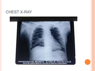CHEST X-RAY
 