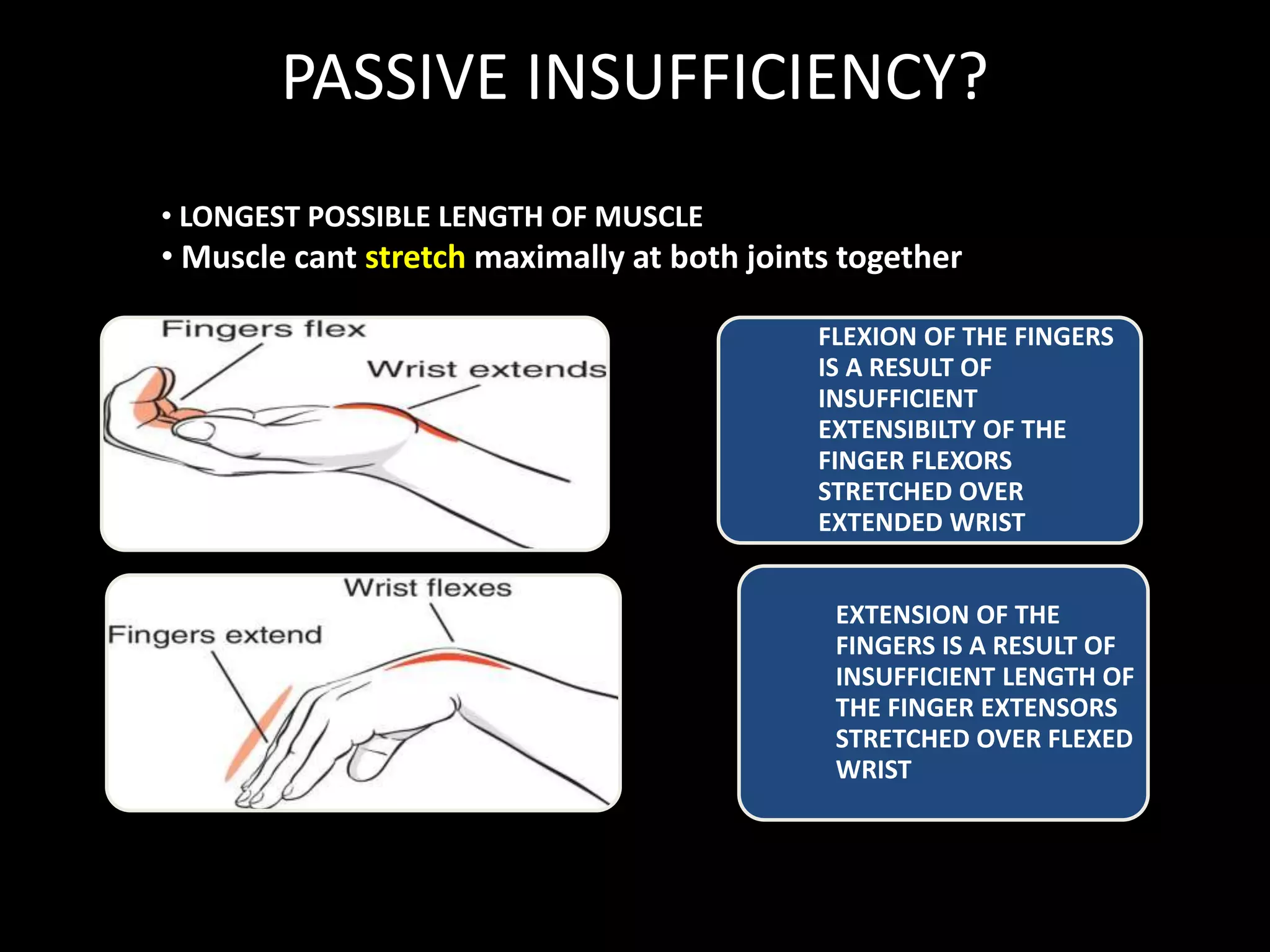 PASSIVE INSUFFICIENCY?
FLEXION OF THE FINGERS
IS A RESULT OF
INSUFFICIENT
EXTENSIBILTY OF THE
FINGER FLEXORS
STRETCHED OVER
EXTENDED WRIST
EXTENSION OF THE
FINGERS IS A RESULT OF
INSUFFICIENT LENGTH OF
THE FINGER EXTENSORS
STRETCHED OVER FLEXED
WRIST
• LONGEST POSSIBLE LENGTH OF MUSCLE
• Muscle cant stretch maximally at both joints together
 