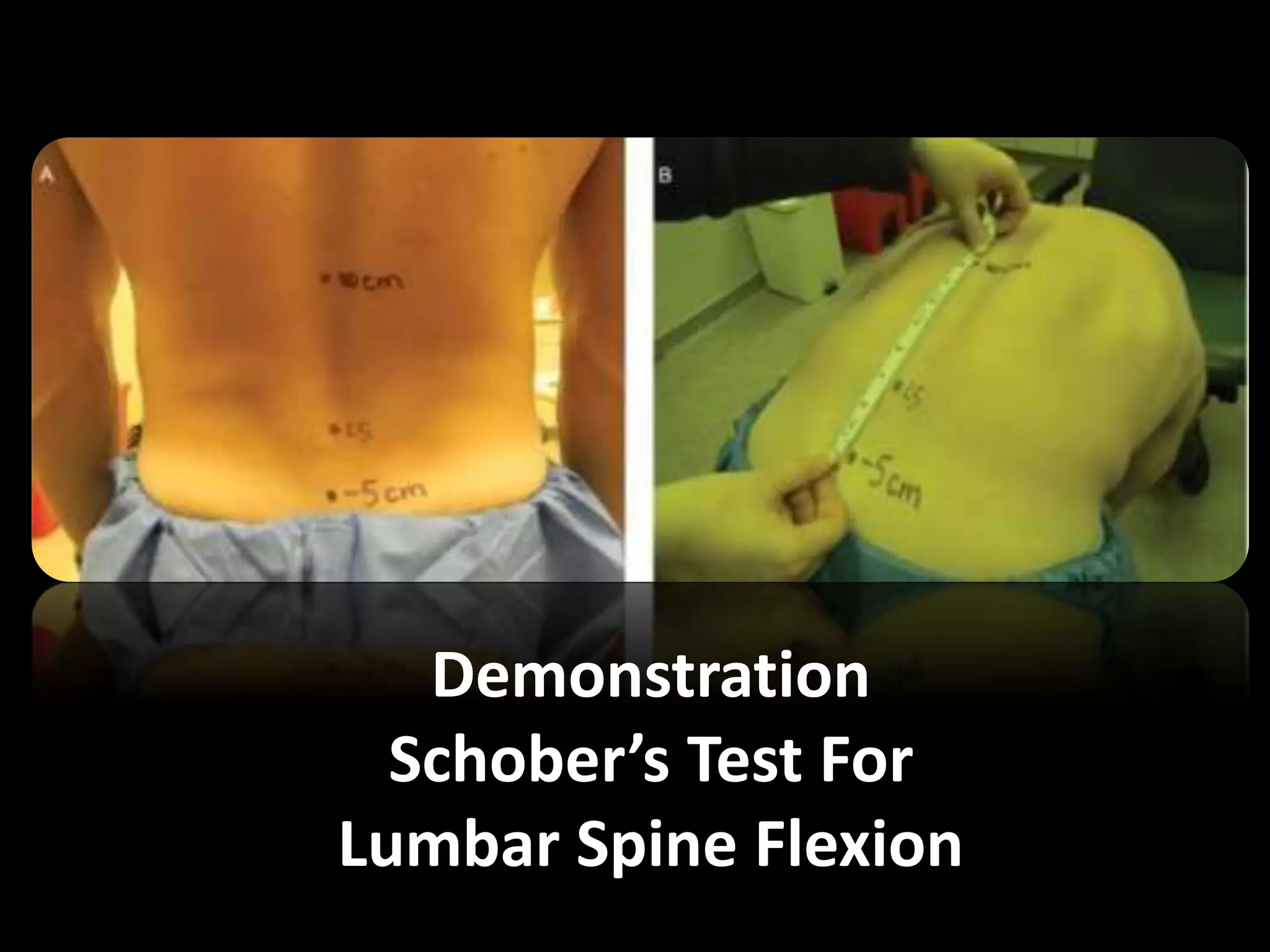 Demonstration
Schober’s Test For
Lumbar Spine Flexion
 