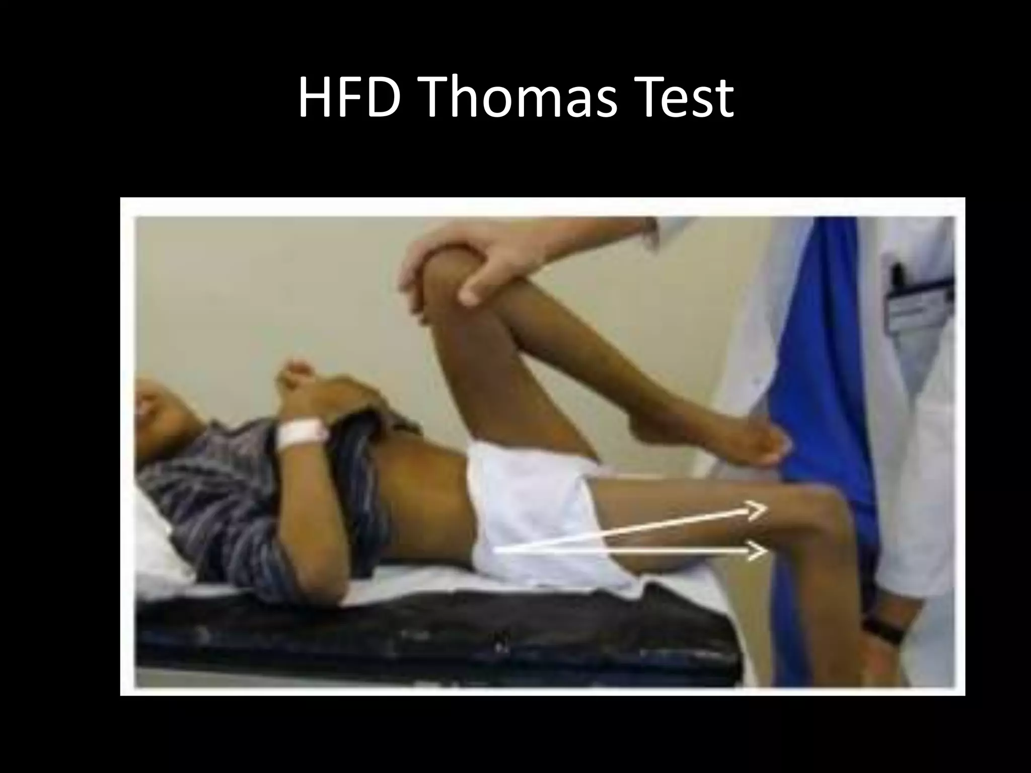HFD Thomas Test
 