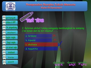 2. Kelainan akibat tulang punggung membungkuk ke samping 
( ke kanan dan ke kiri disebut . . . . 
a. lordosis 
b. kiposis 
c. skoliosis 
d. hepatitis 
 