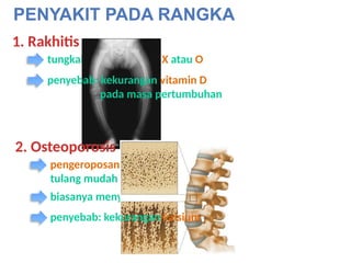 Kaki Rakhitis materi kelas 6 semester 2 bab Rangka .pptx