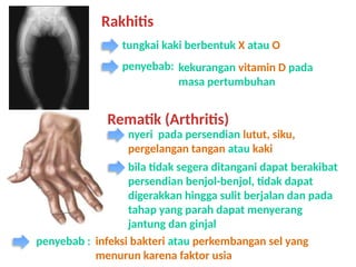 Kaki Rakhitis materi kelas 6 semester 2 bab Rangka .pptx