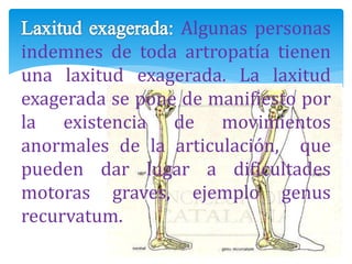 Algunas personas
indemnes de toda artropatía tienen
una laxitud exagerada. La laxitud
exagerada se pone de manifiesto por
la existencia de movimientos
anormales de la articulación, que
pueden dar lugar a dificultades
motoras graves, ejemplo genus
recurvatum.
 
