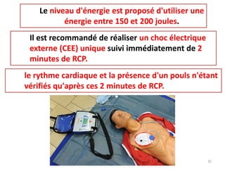 Le niveau d'énergie est proposé d'utiliser une
énergie entre 150 et 200 joules.
Il est recommandé de réaliser un choc électrique
externe (CEE) unique suivi immédiatement de 2
minutes de RCP.
le rythme cardiaque et la présence d'un pouls n'étant
vérifiés qu'après ces 2 minutes de RCP.
32
 