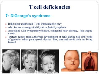 T cell deficiencies
1- DiGeorge's syndrome:
o It the most understood T-cell immunodeficiency
o Also known as congenital thymic aplasia/hypoplasia
o Associated with hypoparathyroidism, congenital heart disease, fish shaped
mouth.
o Defects results from abnormal development of fetus during 6th-10th week
of gestation when parathyroid, thymus, lips, ears and aortic arch are being
formed
 
