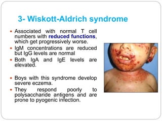 3- Wiskott-Aldrich syndrome
 Associated with normal T cell
numbers with reduced functions,
which get progressively worse.
 IgM concentrations are reduced
but IgG levels are normal
 Both IgA and IgE levels are
elevated.
 Boys with this syndrome develop
severe eczema.
 They respond poorly to
polysaccharide antigens and are
prone to pyogenic infection.
 