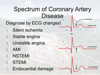 Spectrum of Coronary Artery Disease Diagnose by ECG changes! Silent ischemia Stable angina Unstable angina AMI NSTEMI STEMI Endocardial damage 