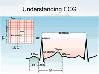 Understanding ECG 