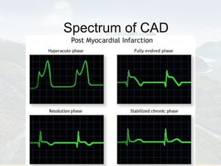 Spectrum of CAD 