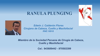 RANULA PLUNGING
Edwin J. Calderón Flores
Cirujano de Cabeza, Cuello y Maxilofacial
RNE:18918
Miembro de la Sociedad Peruana de Cirugía de Cabeza,
Cuello y Maxilofacial
Cel.: 943689442 - 970502399
 