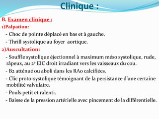 Clinique :
B. Examen clinique :
1)Palpation:
- Choc de pointe déplacé en bas et à gauche.
- Thrill systolique au foyer aortique.
2)Auscultation:
- Souffle systolique éjectionnel à maximum méso systolique, rude,
râpeux, au 2e EIC droit irradiant vers les vaisseaux du cou.
- B2 atténué ou aboli dans les RAo calcifiées.
- Clic proto-systolique témoignant de la persistance d’une certaine
mobilité valvulaire.
- Pouls petit et ralenti.
- Baisse de la pression artérielle avec pincement de la différentielle.
 
