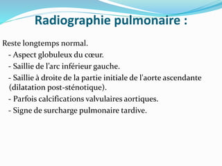 Radiographie pulmonaire :
Reste longtemps normal.
- Aspect globuleux du cœur.
- Saillie de l’arc inférieur gauche.
- Saillie à droite de la partie initiale de l'aorte ascendante
(dilatation post-sténotique).
- Parfois calcifications valvulaires aortiques.
- Signe de surcharge pulmonaire tardive.
 