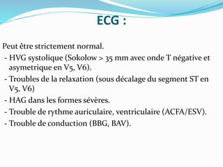 ECG :
Peut être strictement normal.
- HVG systolique (Sokolow > 35 mm avec onde T négative et
asymetrique en V5, V6).
- Troubles de la relaxation (sous décalage du segment ST en
V5, V6)
- HAG dans les formes sévères.
- Trouble de rythme auriculaire, ventriculaire (ACFA/ESV).
- Trouble de conduction (BBG, BAV).
 