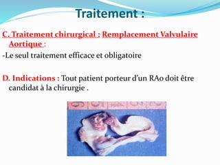 Traitement :
C. Traitement chirurgical : Remplacement Valvulaire
Aortique :
-Le seul traitement efficace et obligatoire
D. Indications : Tout patient porteur d’un RAo doit être
candidat à la chirurgie .
 