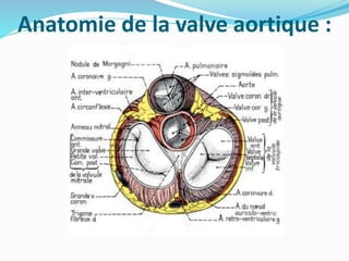 Anatomie de la valve aortique :
 