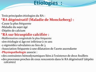Etiologies :
Trois principales étiologies du RA :
*RA dégénératif (Maladie de Monckeberg) :
-Cause la plus fréquente
-Maladie du sujet âgé
-Dépôts de calcium
*RA sur bicuspidie calcifiée :
-Malformation congénitale la plus fréquente
-1ère étiologie si âge est inférieur à 70 ans
-2 sigmoïdes valvulaires au lieu de 3
-Association fréquente à une dilatation de l'aorte ascendante
-Physiopathologie associe :
+des contraintes hémodynamiques liées à l'existence de deux feuillets
+des processus proches de ceux rencontrés dans le RA dégénératif (dépôts
calcaires)
 