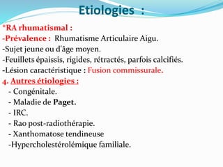 Etiologies :
*RA rhumatismal :
-Prévalence : Rhumatisme Articulaire Aigu.
-Sujet jeune ou d'âge moyen.
-Feuillets épaissis, rigides, rétractés, parfois calcifiés.
-Lésion caractéristique : Fusion commissurale.
4. Autres étiologies :
- Congénitale.
- Maladie de Paget.
- IRC.
- Rao post-radiothérapie.
- Xanthomatose tendineuse
-Hypercholestérolémique familiale.
 