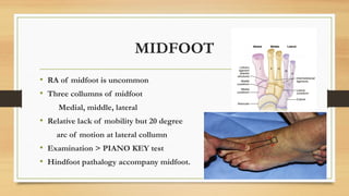 RHEUMATOID ARTHRITIS OF FOOT DIAGNOSIS AND SURGICAL MANAGEMENT.pptx