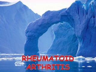 RHEUMATOID ARTHRITIS  MANAGEMENT 