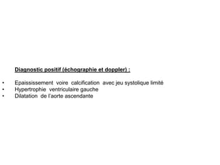 Diagnostic positif (échographie et doppler) :

•   Epaississement voire calcification avec jeu systolique limité
•   Hypertrophie ventriculaire gauche
•   Dilatation de l’aorte ascendante
 