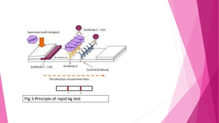 Fig:3-Principle of rapid Ag test
 