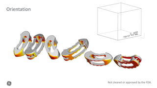 Orientation
Not cleared or approved by the FDA.
 