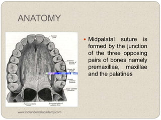 ANATOMY
 Midpalatal suture is
formed by the junction
of the three opposing
pairs of bones namely
premaxillae, maxillae
and the palatines
www.indiandentalacademy.com
 