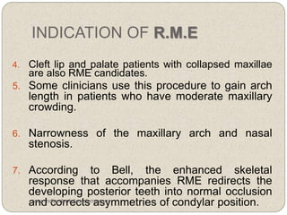 INDICATION OF R.M.E
4. Cleft lip and palate patients with collapsed maxillae
are also RME candidates.
5. Some clinicians use this procedure to gain arch
length in patients who have moderate maxillary
crowding.
6. Narrowness of the maxillary arch and nasal
stenosis.
7. According to Bell, the enhanced skeletal
response that accompanies RME redirects the
developing posterior teeth into normal occlusion
and corrects asymmetries of condylar position.www.indiandentalacademy.com
 